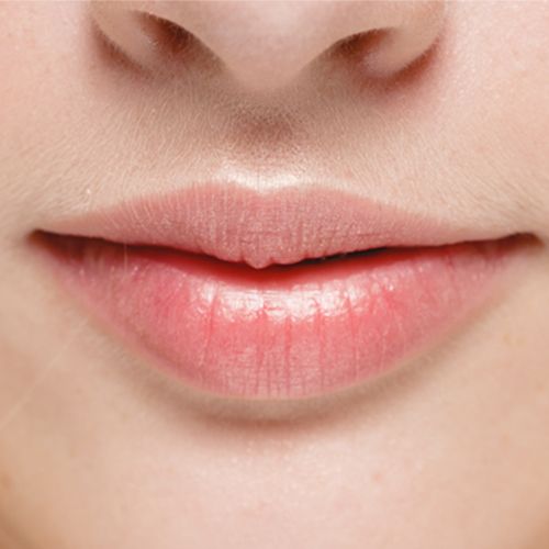 Depilación láser labio superior en Albacete Depilación láser labio superior en Albacete