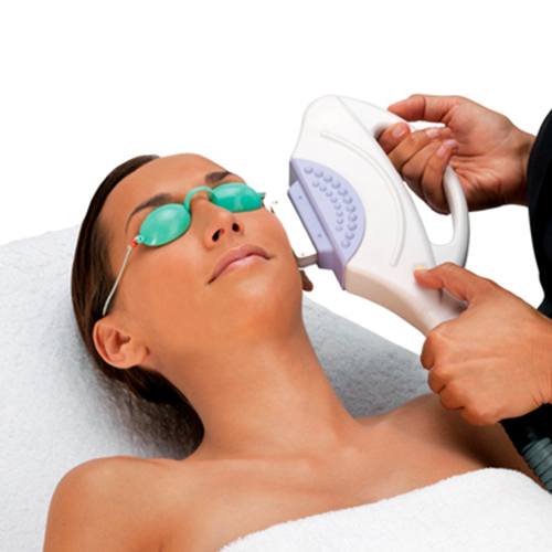 Fotorejuvenecimiento-EDIT