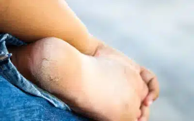 ¿Sabías de la importancia de tus pies?